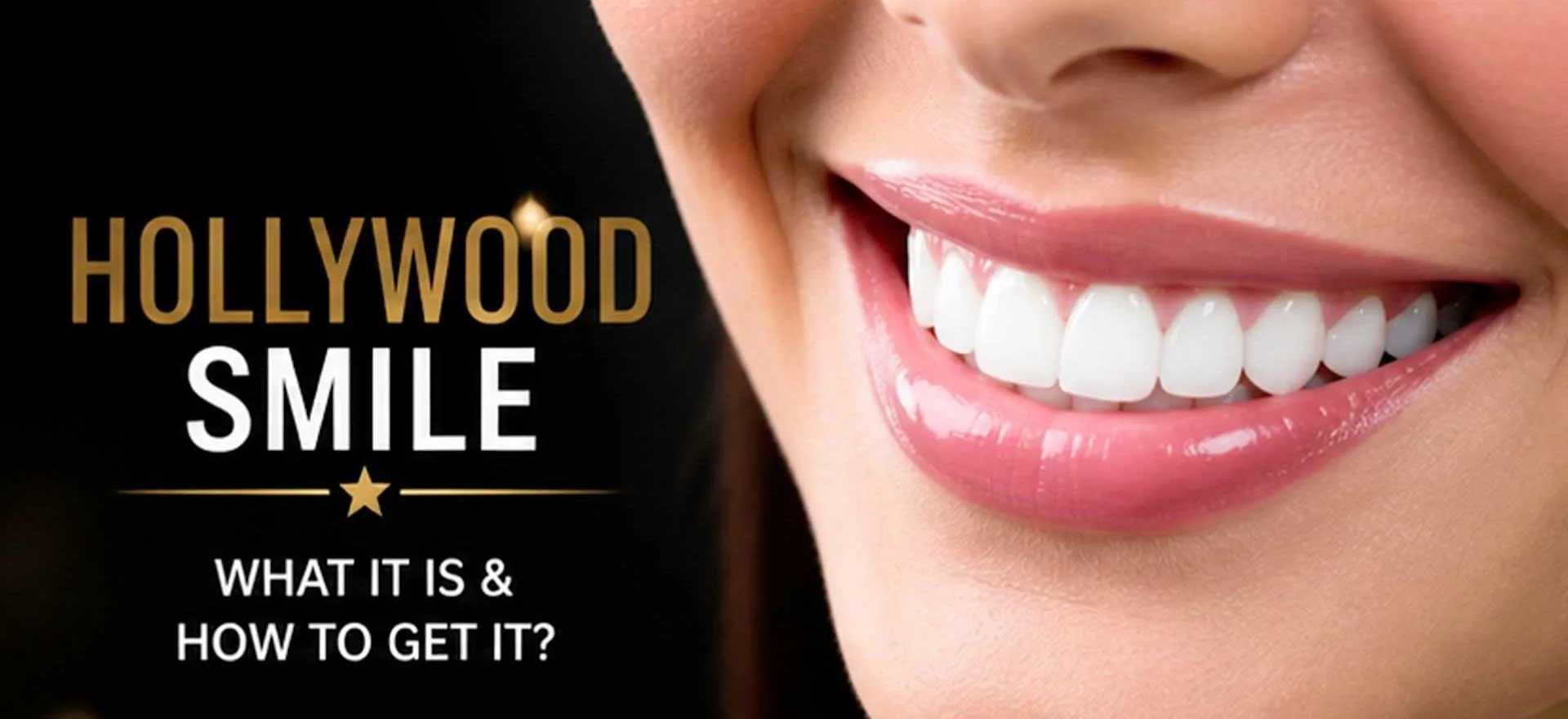 Hollywood Smile in Vietnam: What It Costs, How Long It Takes, and Is It Worth It?