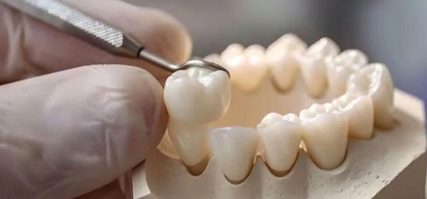 Professional Teeth Whitening in Vietnam: What It Costs and What to Expect