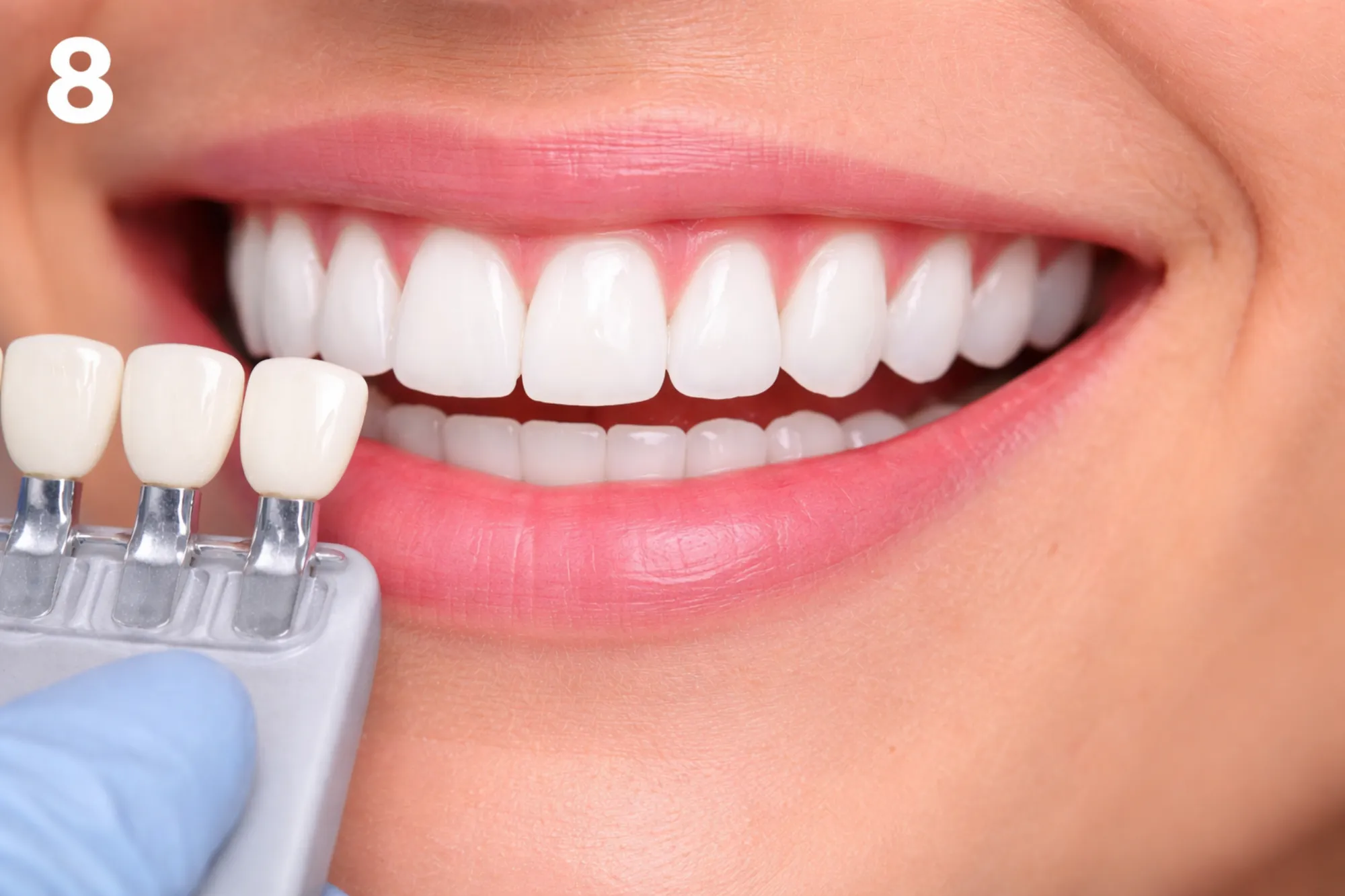 Teeth Whitening